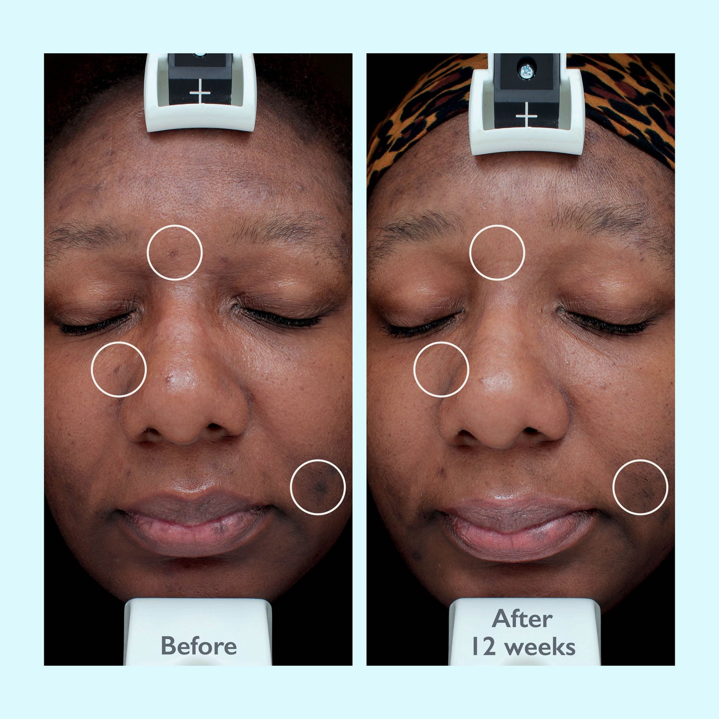 Restorsea PRO Intensive Treatment 10x Face Serum