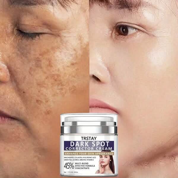 Dark Spot Corrector Cream Eliminates Dark Spots, Fades Dark Spots