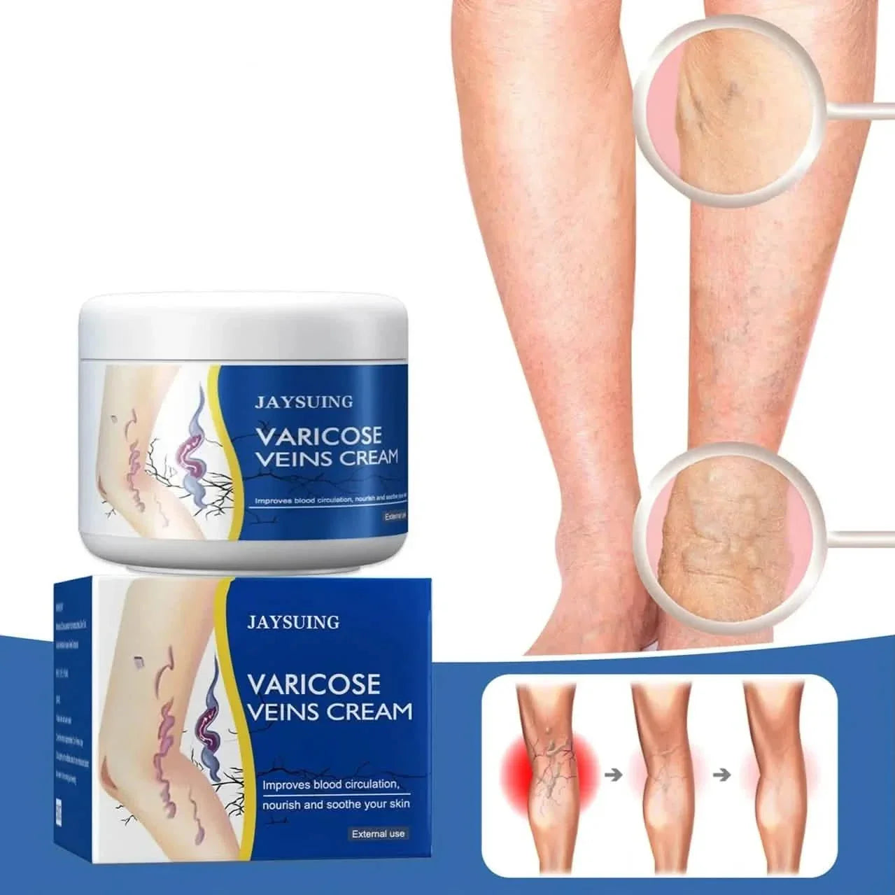 Pain Relief Leg Spider Veins Vasculitis Promote Circulation Smooth Metabolism 30g Exfoliation