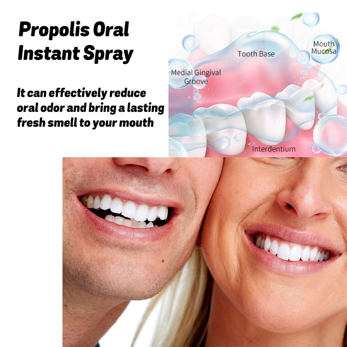 Propolis Oral Instant Spray, Oral Care Product for Daily Oral Care