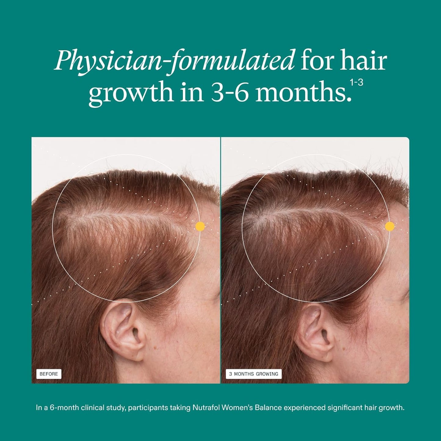 Nutrafol Women's Hair Growth Nutraceutical Ages 45 and Up,