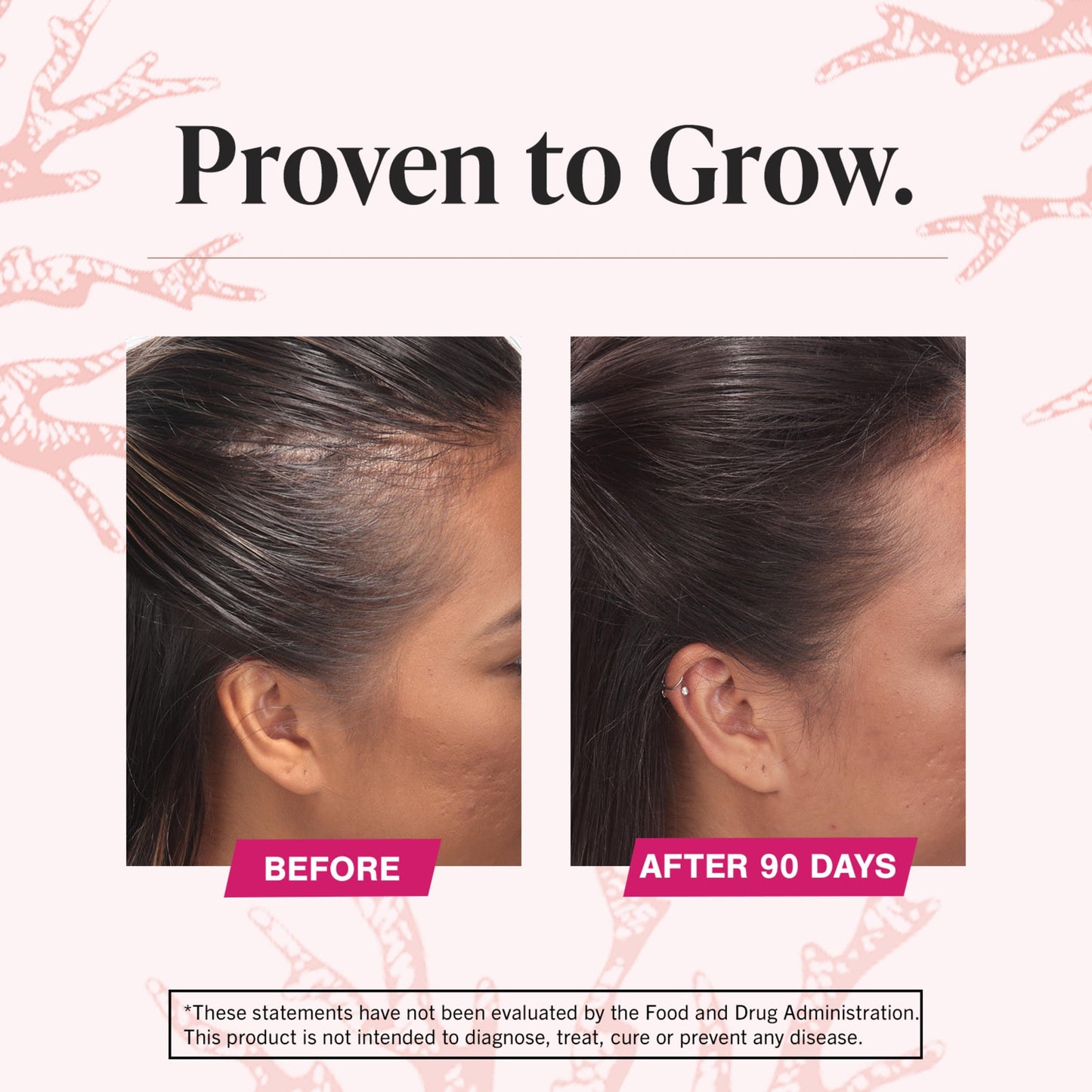 Suplementos Viviscal para el crecimiento del cabello para mujeres, para un cabello más grueso y voluminoso, nutre el cabello fino y con caída, con complejo de colágeno patentado, 180 tabletas, suministro para 3 meses