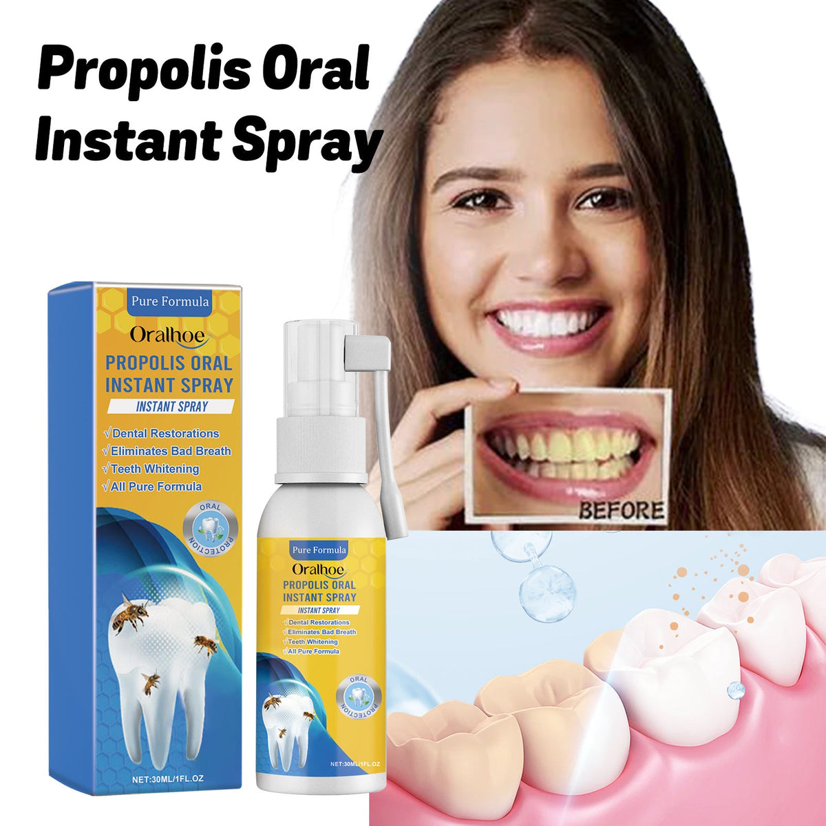 Propolis Oral Instant Spray, Oral Care Product for Daily Oral Care