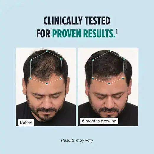 Nutrafol Men Balance Hair Growth Supplement Pack of 2