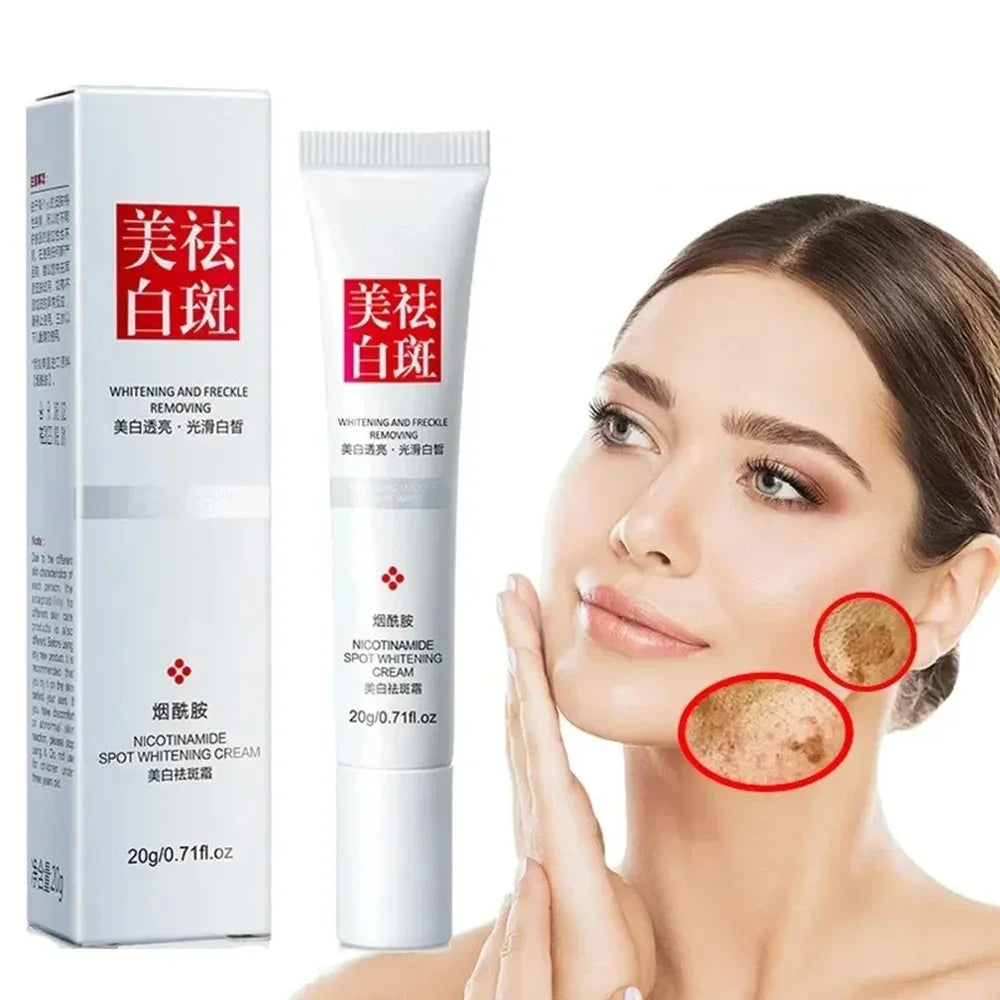 1/3/5pcs Fades Freckle Dark Spots Face Cream Niacinamide Whitening Cream Vitamin E Improve Dullness Fast Brighten Nourish Skin