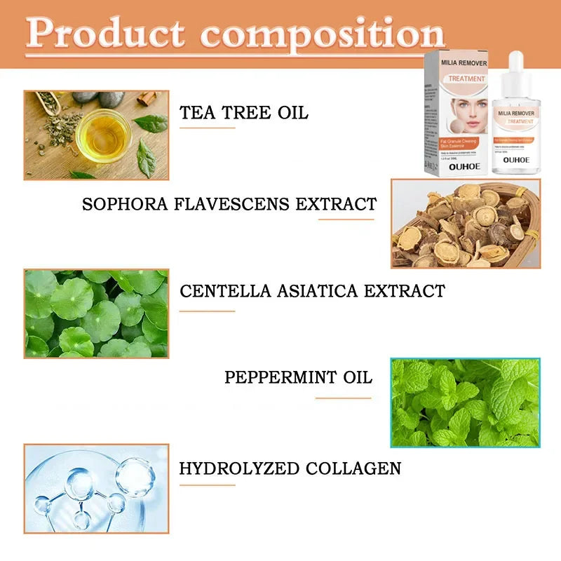 Fat Granules Removal Eye Serum Eye Milia Repair Treatment Products Wrinkle Lifting Moisturizing Anti-Puffiness Korean Skin Care