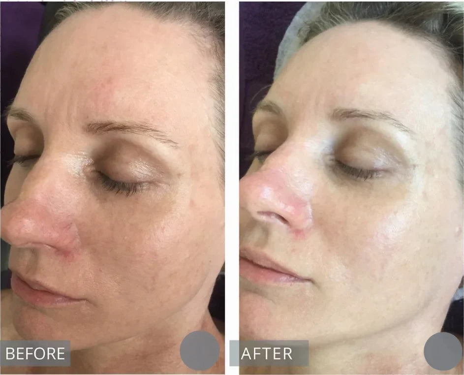 Centella Serum Nourish Improvement Dry Skin Smoothing Tightening Brightening Moisturizing Hyaluronic Acid Face Essence Skin Care