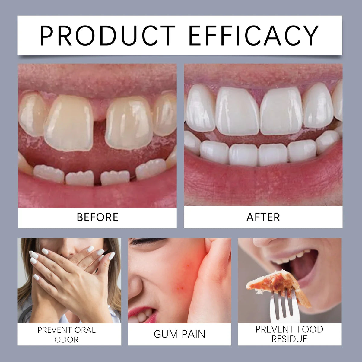 Denture Fixing Adhesive Cream Strong Complete Professional Dentures Glue Prevents Denture Loosening Care Fixed Adhesive 40g