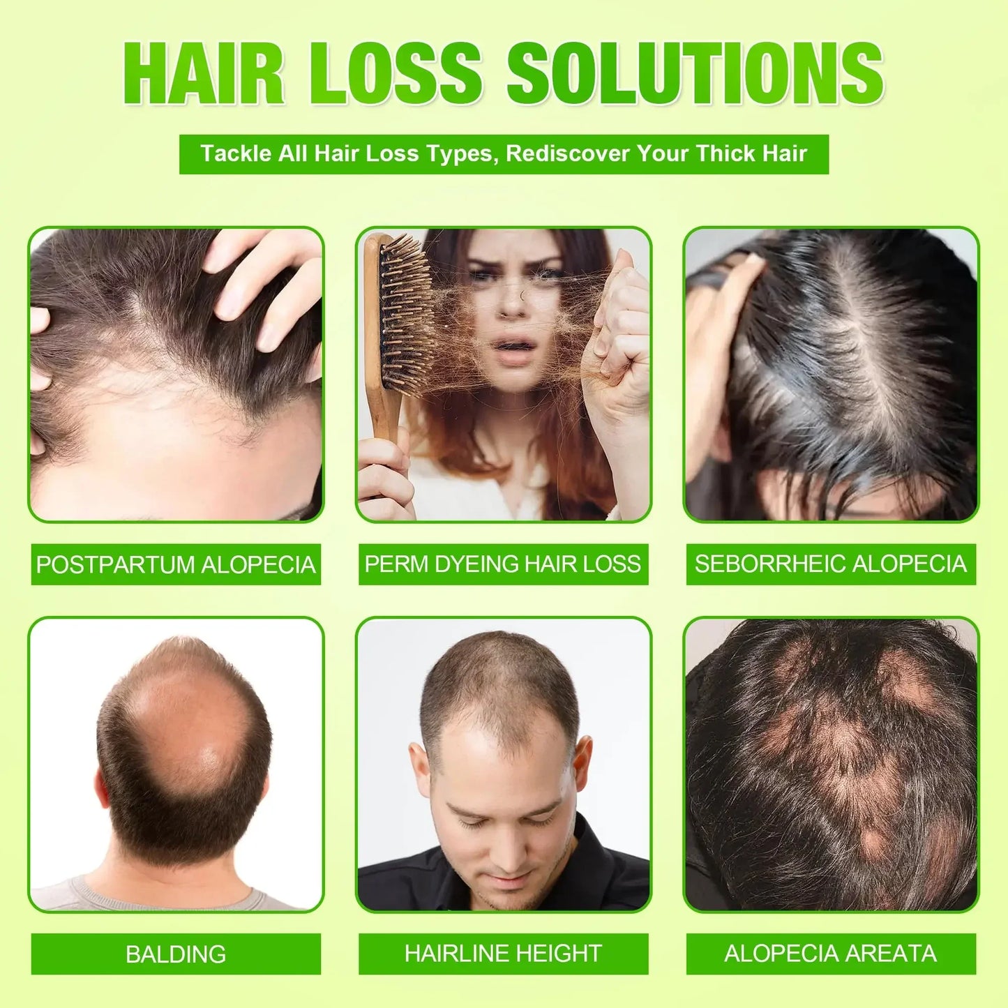 Anti-Hair Loss Scalp Care Roller Serum Kit Nourishes Roots Strengthens Hair Prevents Baldness Daily Care