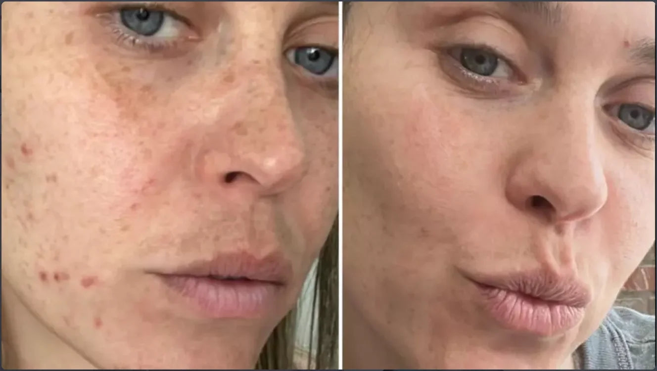 Centella Serum Nourish Improvement Dry Skin Smoothing Tightening Brightening Moisturizing Hyaluronic Acid Face Essence Skin Care