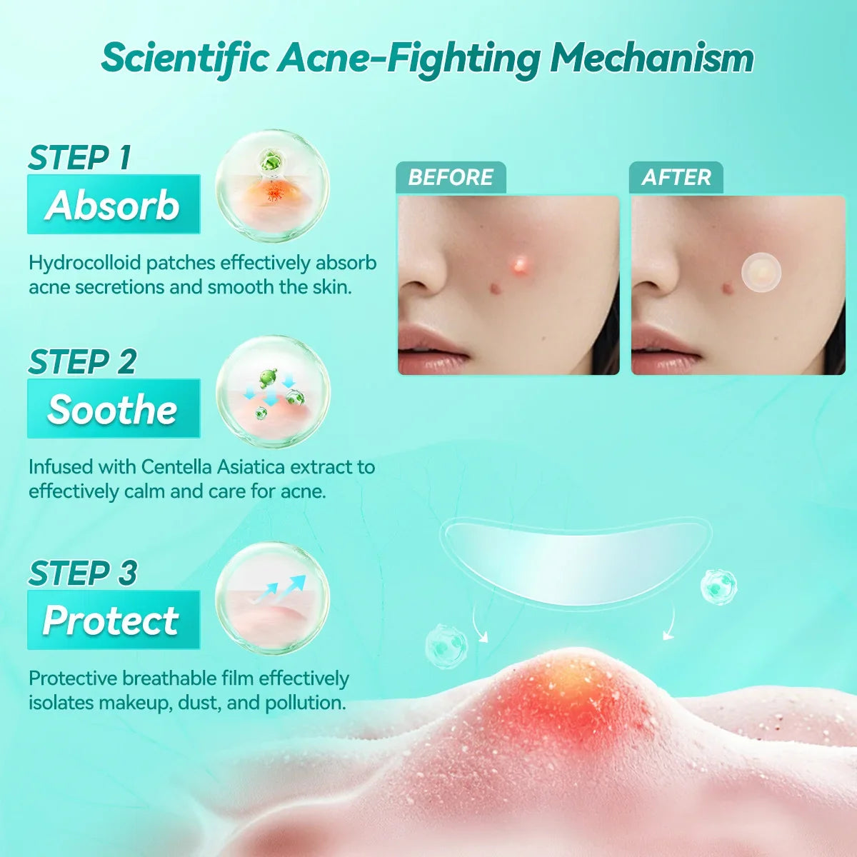 LANBENA Acne Pimple Patch Daily Use and Night Use Invisible Acne Stickers Blemish Treatment Acne Concealer Makeup