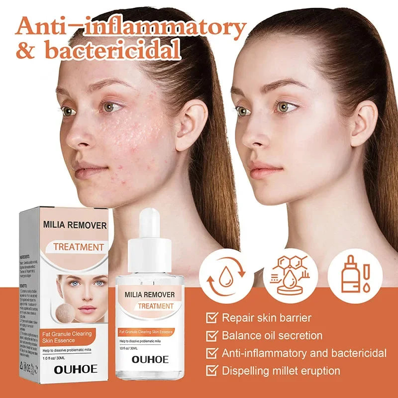 Fat Granules Removal Eye Serum Eye Milia Repair Treatment Products Wrinkle Lifting Moisturizing Anti-Puffiness Korean Skin Care