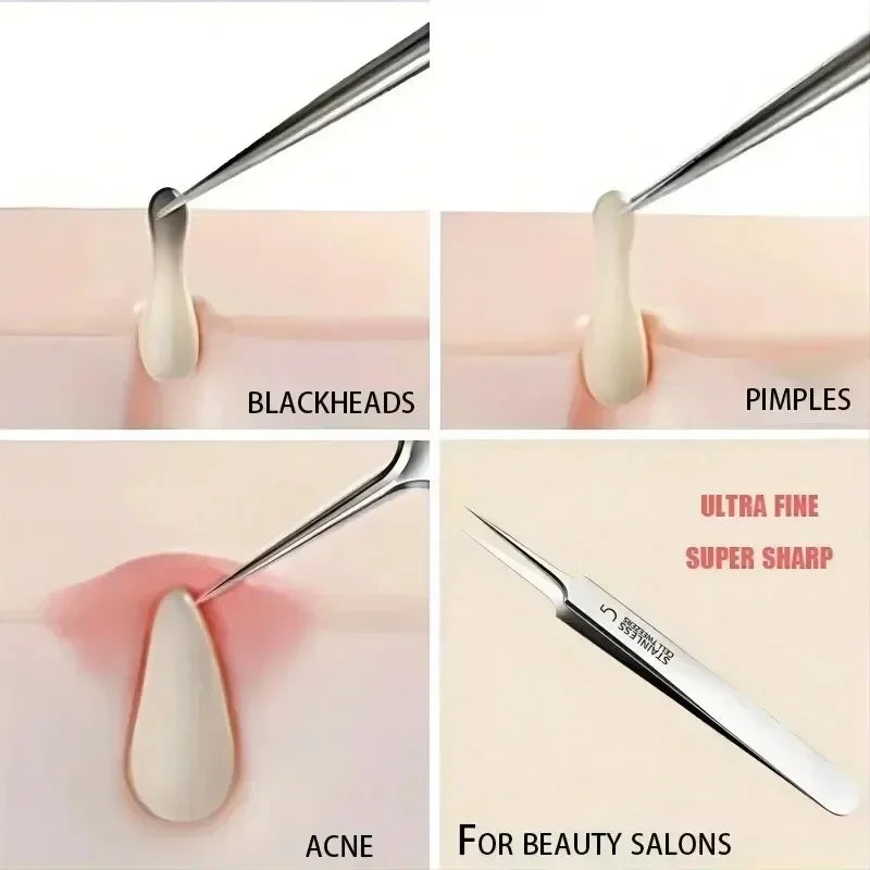 German 1/3/8Pack Extra Fine No. 5 Cellular Acne Blackhead Tweezers - Facial Beauty Remove Acne Needle Tools for Skin Care Tools