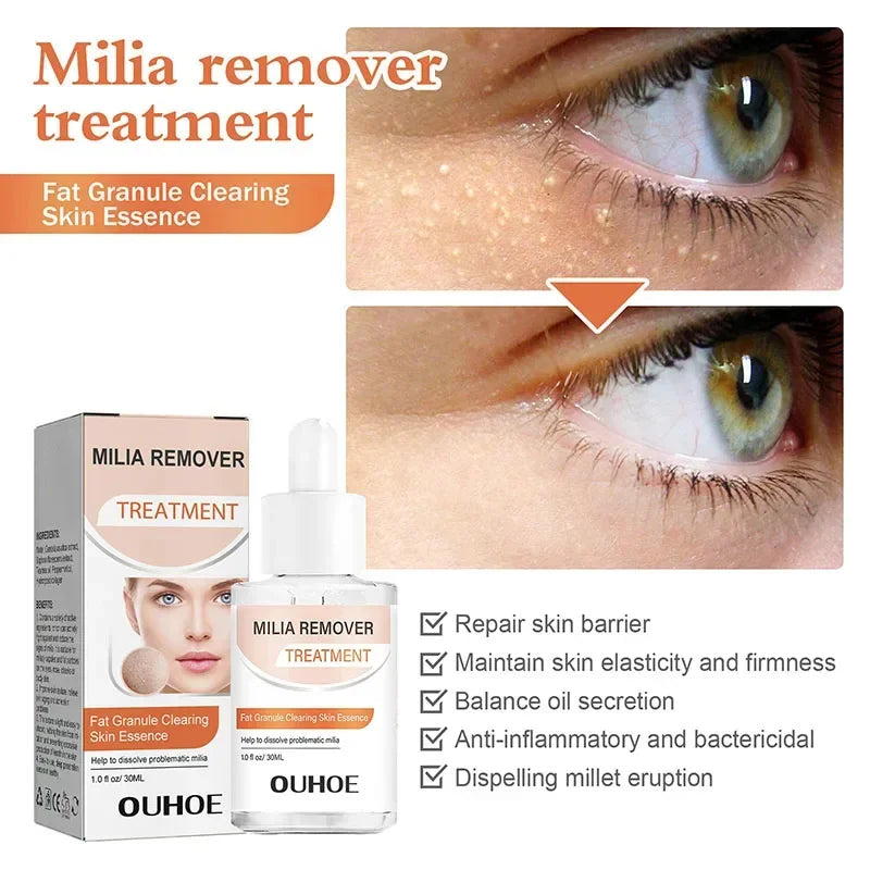 Fat Granules Removal Eye Serum Eye Milia Repair Treatment Products Wrinkle Lifting Moisturizing Anti-Puffiness Korean Skin Care