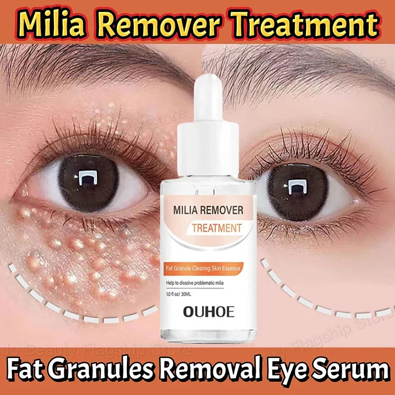 Fat Granules Removal Eye Serum Eye Milia Repair Treatment Products Wrinkle Lifting Moisturizing Anti-Puffiness Korean Skin Care