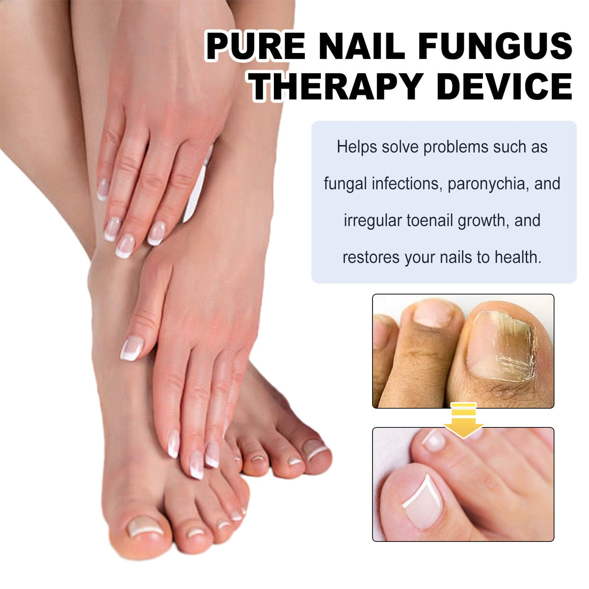 Rotten Nail Mild Cleaning Gray Nail Health Care Device