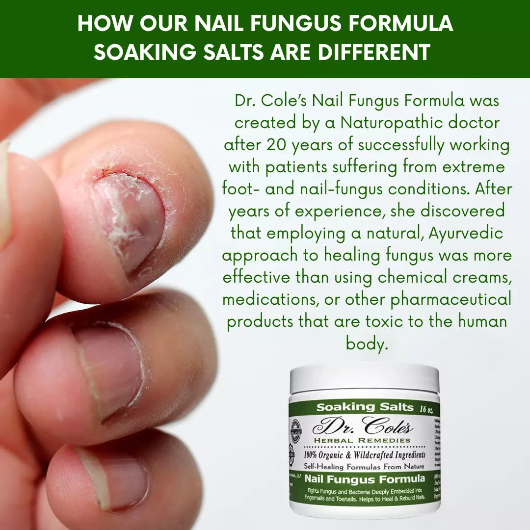 13 - Fórmula de Sales Orgánicas para Hongos en las Uñas del Dr. Cole
